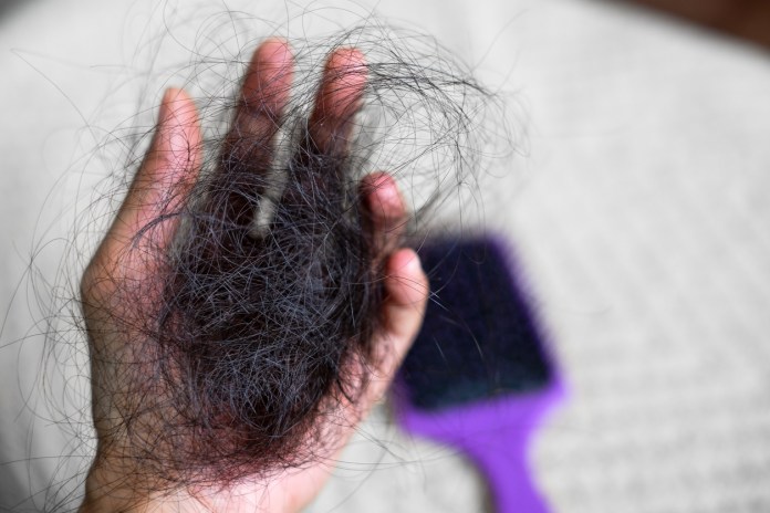 hair loss problem